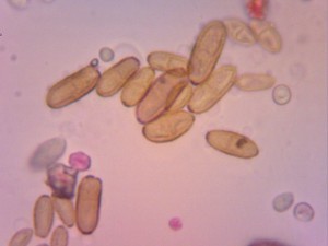 Cladosporium