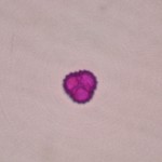 Ambrosia sp. 60X Ambrosia sp. 60X