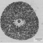 Figure 2. A section through an aphid bacteriocyte.