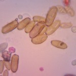 Cladosporium