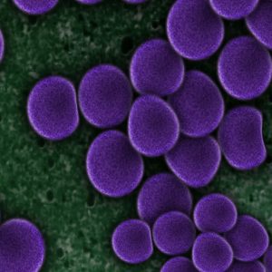 Daptomycin on Vascular Graft Infections