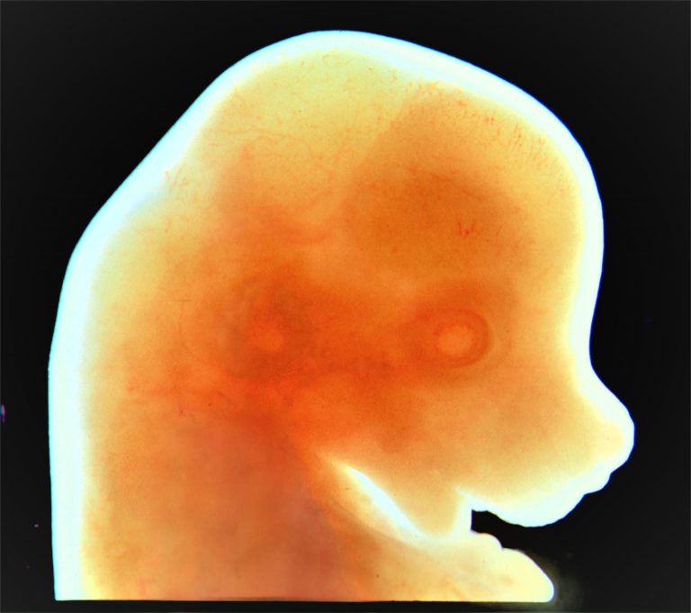 jumping genes - Craniofacial_mouse_embryo gene