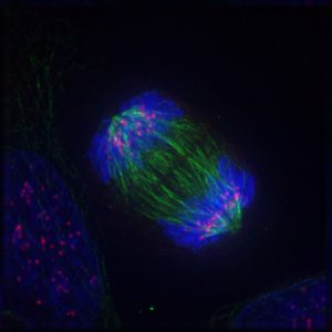 Anaphase mitosis