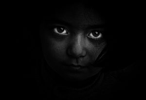 blindness eyes