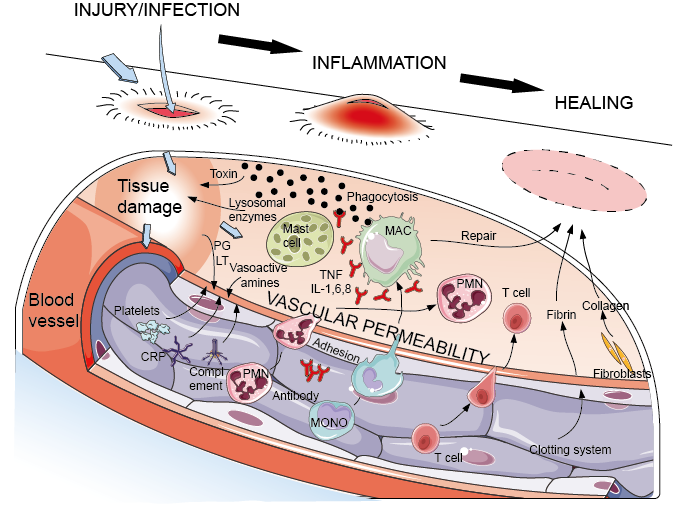 Acute inflammation