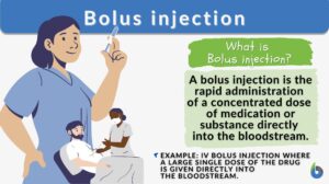 Bolus injection definition and example
