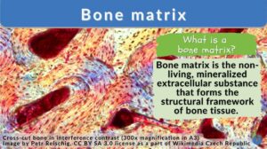 Bone matrix definition and example