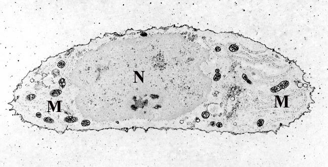 Chondrocyte - calcium stain