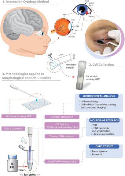 Exfoliative cytology for ocular cell sample collection