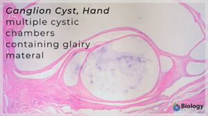 Ganglia definition
