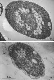 Gas vacuoles
