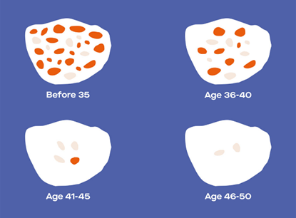 High FSH indicate fewer eggs