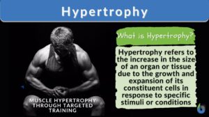 Hypertrophy definition and example