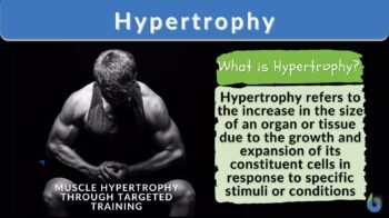 Hypertrophy definition and example