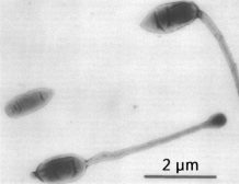 Hyphomicrobium cell budding