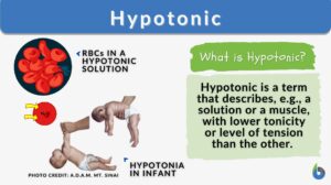 Hypotonic definition and example