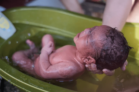 Lanugo on newborn