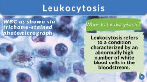 Leukocytes definition and example