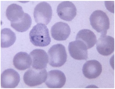 Plasmodium vivax ring trophozoites