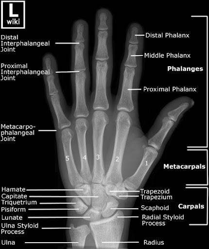 Radiographic Anatomy of a human left hand
