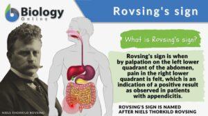Rovsing's sign definition and example