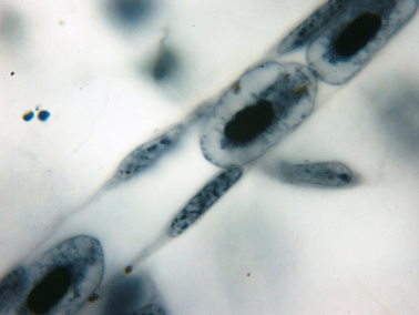 Simple squamous epithelial cells as seen in blood capillaries