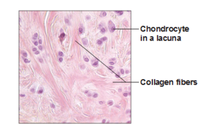 Structure of Fibrocartilage