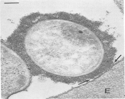 Transmission electron microscopy of glycocalyx of human erythrocytes