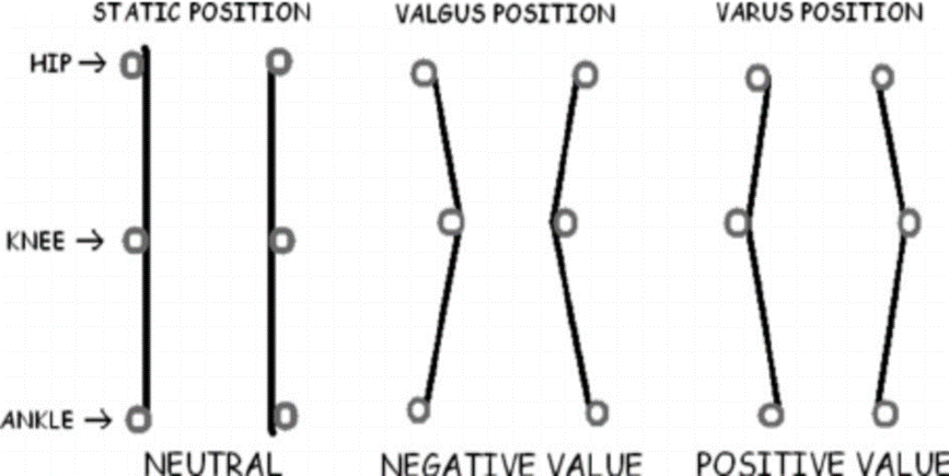Understanding the bone angulation deformity, valgus and varus