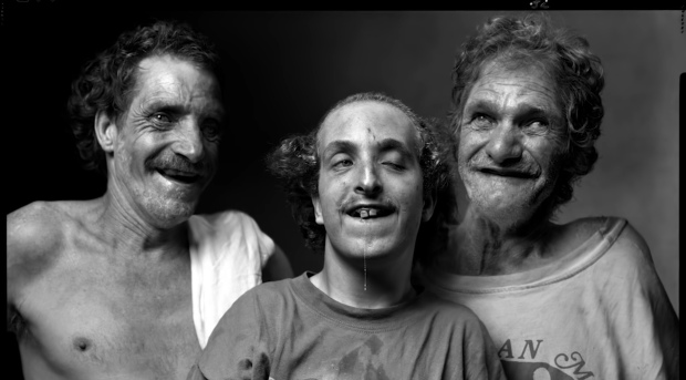 Whittaker family with malformations