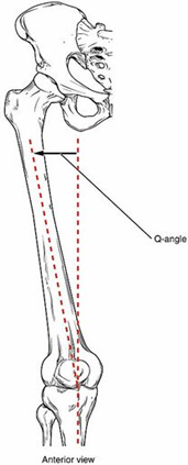 angle of deformity or Q angle