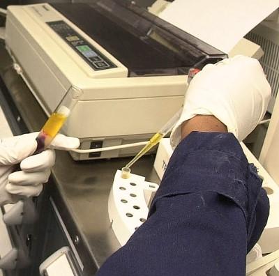 blood serum preparation