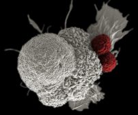 cancer cell attacked by t cells