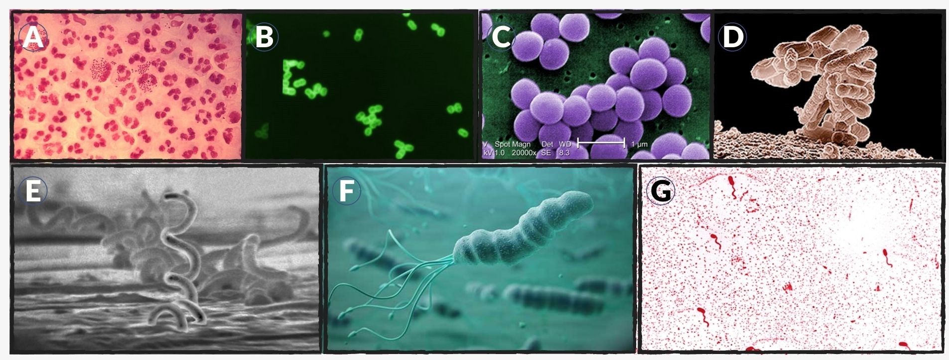 cell morphology of different bacteria