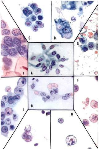 cells from exfoliative cytology tests done for gastrointestinal tract