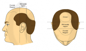 crown of head