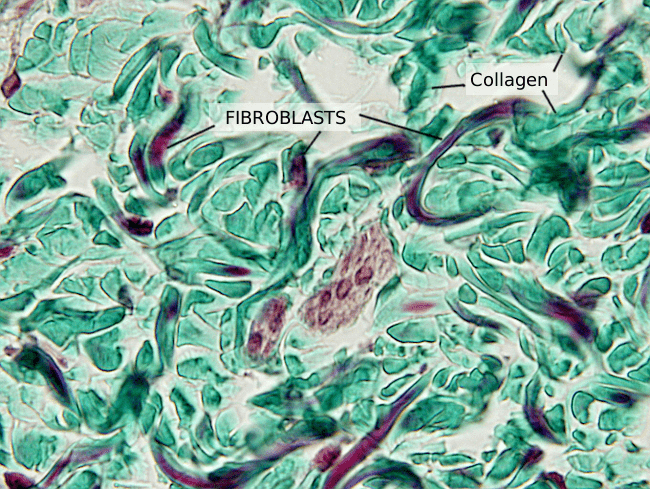 dermal fibrobalst under microscope