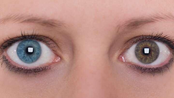 human chimera - eye colors