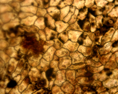 Surface view of a vertebrate peritoneum