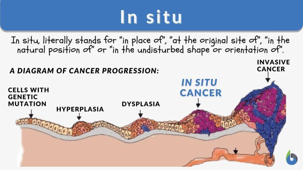 In situ Definition and Examples - Biology Online Dictionary