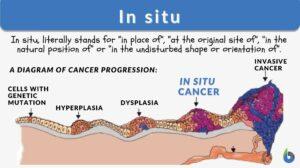 in situ definition and example