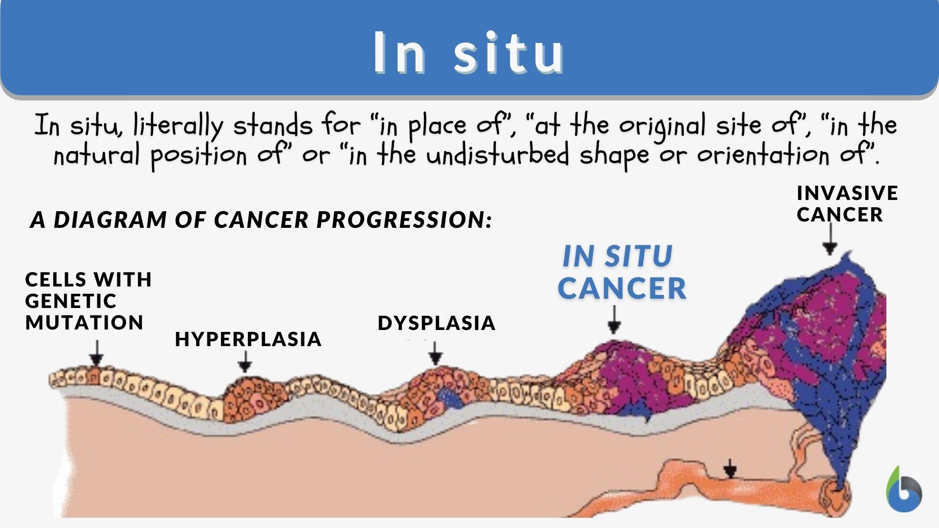 In situ что это такое