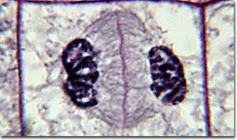 late anaphase