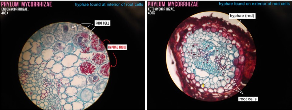 mycorrhizae and roots - microscopy