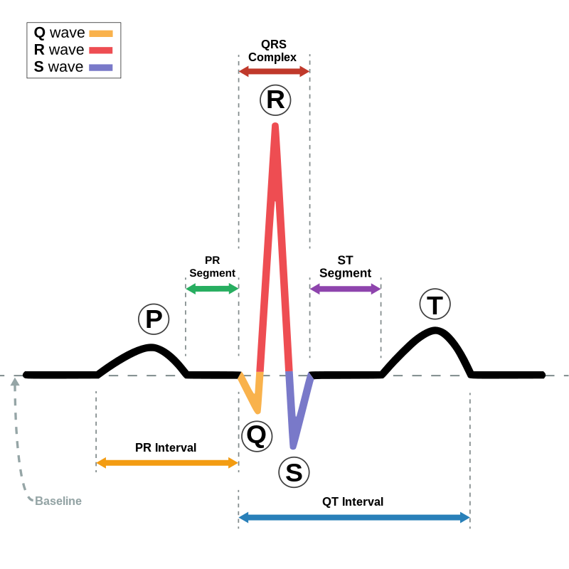 Schematic diagram of normal sinus human heart rhythm as seen on ECG