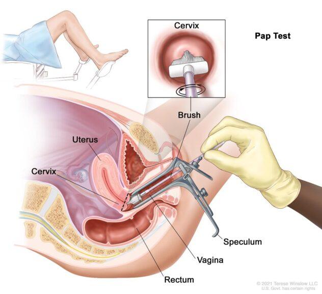 pap smear or pap test