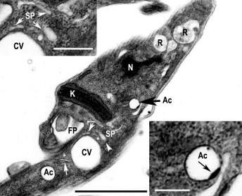 protist cells with contractile vacuoles