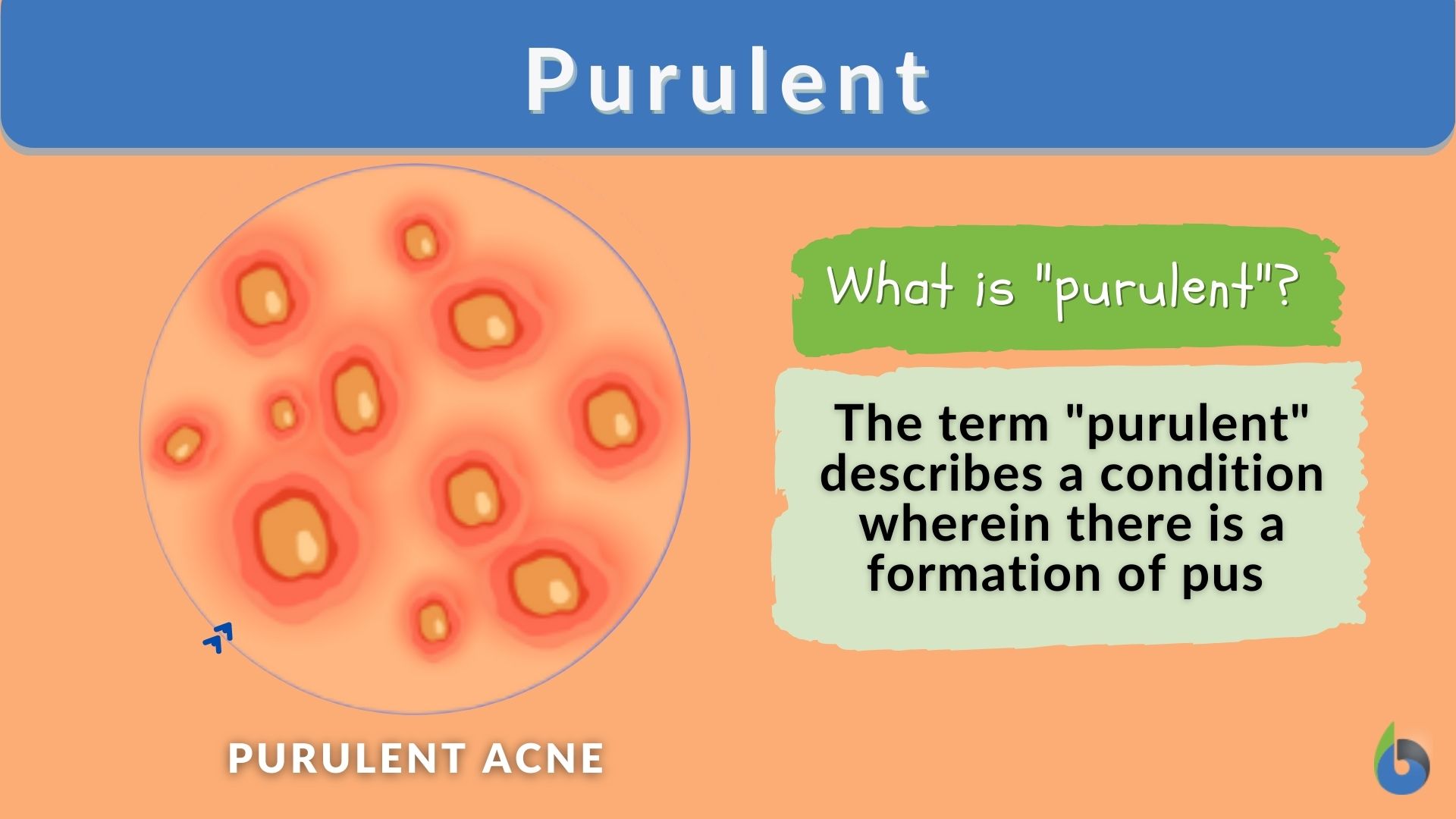 purulent nasal drainage