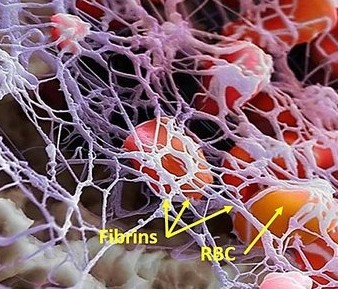 rbc fibrin