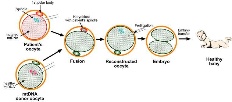 schematic diagram of mitochondrial replacement therapy